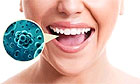 Микрофлора полости рта и лишний вес связаны между собой