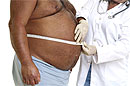 Ожирение защищает мужчин от ревматоидного артрита
